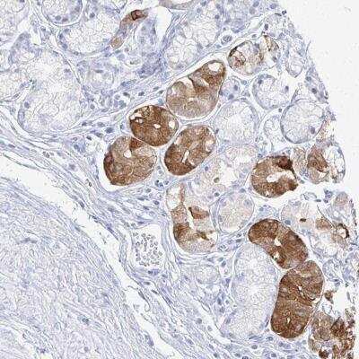 Immunohistochemistry-Paraffin: PRR20A Antibody [NBP2-46857]