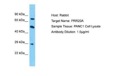 Western Blot: PRR20A Antibody [NBP2-83423]