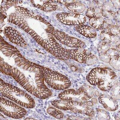 Immunohistochemistry: PRR23A Antibody [NBP2-59795]