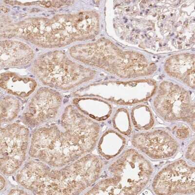 Immunohistochemistry: PRR26 Antibody [NBP2-38084]