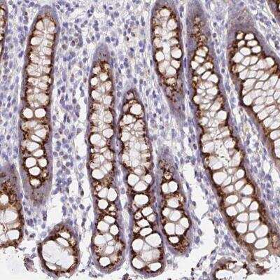 Immunohistochemistry-Paraffin: PRR36 Antibody [NBP2-49372]