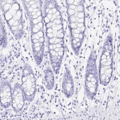 Immunohistochemistry-Paraffin: PRR4 Antibody [NBP1-81289]