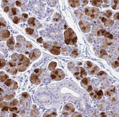 Immunohistochemistry-Paraffin: PRR4 Antibody [NBP1-81289]
