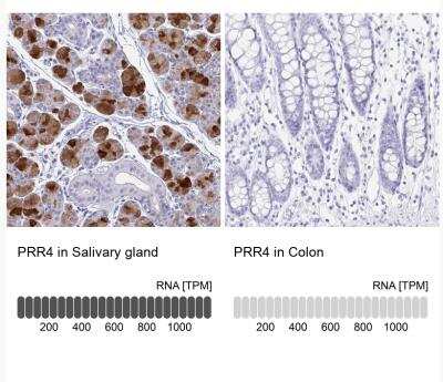 Immunohistochemistry-Paraffin: PRR4 Antibody [NBP1-81289]