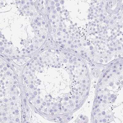 Immunohistochemistry-Paraffin: PRR4 Antibody [NBP1-81289]