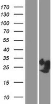 Western Blot: PRR4 Overexpression Lysate [NBP2-08315]