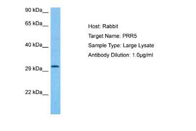 Western Blot: PRR5 Antibody [NBP1-91482]
