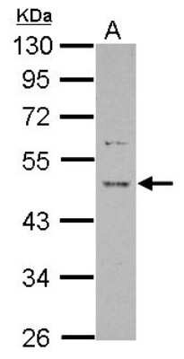 Western Blot: PRR5 Antibody [NBP2-19968]