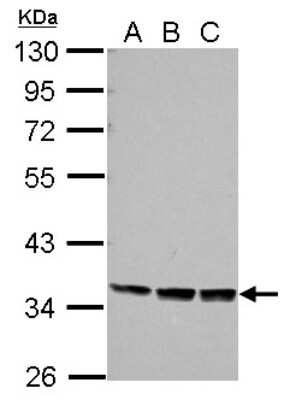 Western Blot: PRR5 Antibody [NBP2-19969]