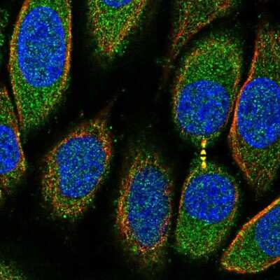 Immunocytochemistry/ Immunofluorescence: PRR5L Antibody [NBP2-56633]