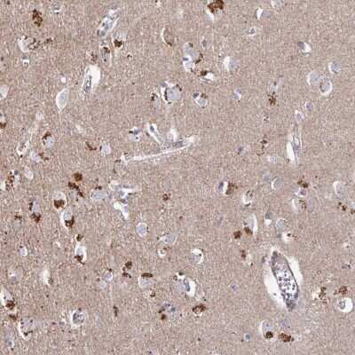 Immunohistochemistry: PRR5 Antibody [NBP2-49114]