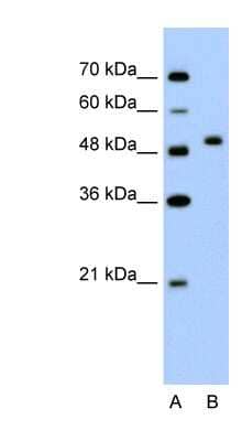 Western Blot: PRR5L Antibody [NBP1-57688]