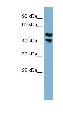 Western Blot: PRR5L Antibody [NBP1-57689]