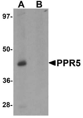 Western Blot: PRR5 AntibodyBSA Free [NBP1-76568]