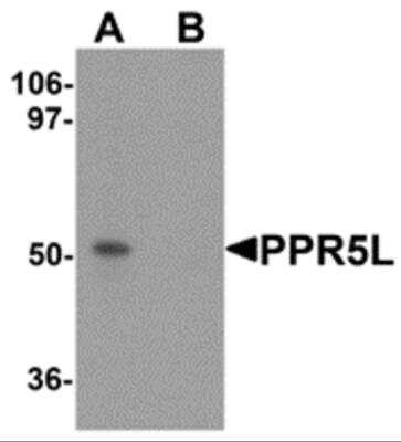 Western Blot: PRR5L AntibodyBSA Free [NBP2-82025]