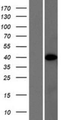 Western Blot: PRR5L Overexpression Lysate [NBP2-06263]