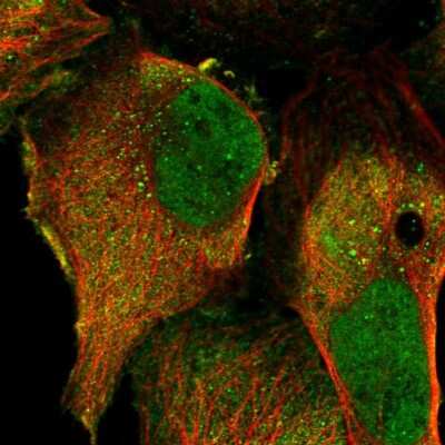 Immunocytochemistry/ Immunofluorescence: PRR7 Antibody [NBP2-13815]