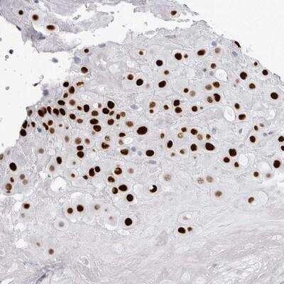 Immunohistochemistry-Paraffin: PRR9 Antibody [NBP1-91041]