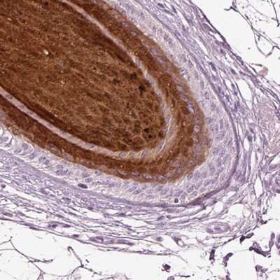 Immunohistochemistry-Paraffin: PRR9 Antibody [NBP1-91041]