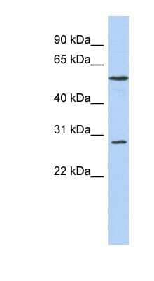 Western Blot: PRRC1 Antibody [NBP1-70687]