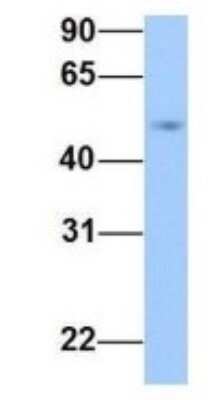 Western Blot: PRRC1 Antibody [NBP1-70687]