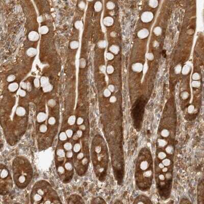 Immunohistochemistry-Paraffin: PRRC2C Antibody [NBP1-88702]