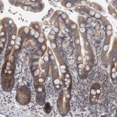Immunohistochemistry-Paraffin: PRRC2C Antibody [NBP1-88703]