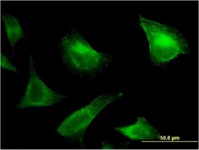 Immunocytochemistry/ Immunofluorescence: PRRG1 Antibody (1C7) [H00005638-M05]