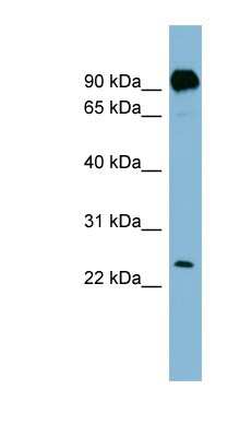 Western Blot: PRRG1 Antibody [NBP1-59906]