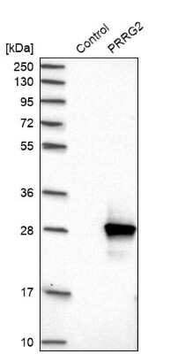 Western Blot: PRRG2 Antibody [NBP1-87229]