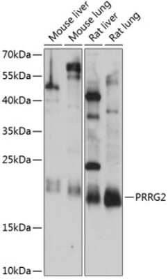 Western Blot: PRRG2 AntibodyAzide and BSA Free [NBP2-93368]