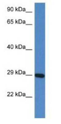 Western Blot: PRRG3 Antibody [NBP1-79325]