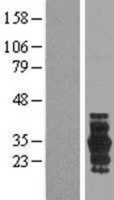 Western Blot: PRRG3 Overexpression Lysate [NBP2-06352]