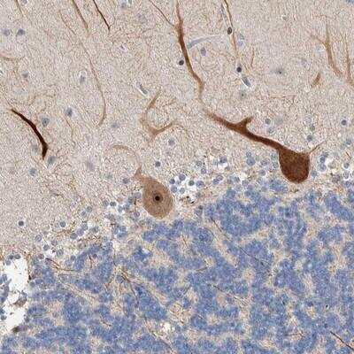 Immunohistochemistry: PRRG4 Antibody [NBP1-80674]