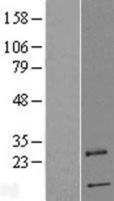 Western Blot: PRRG4 Overexpression Lysate [NBL1-14838]