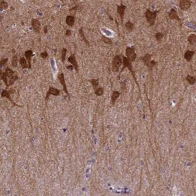 Immunocytochemistry/ Immunofluorescence: PRRT1 Antibody [NBP2-68749]