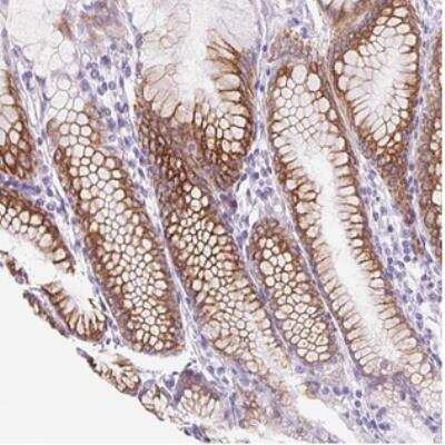 Immunohistochemistry: PRRT1 Antibody [NBP2-30641]