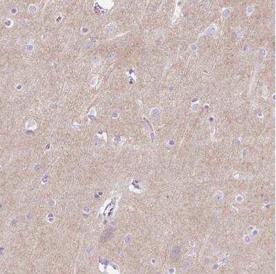 Immunohistochemistry-Paraffin: PRRT1 Antibody [NBP2-30641]