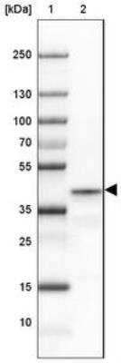 Western Blot: PRRT1 Antibody [NBP2-30641]