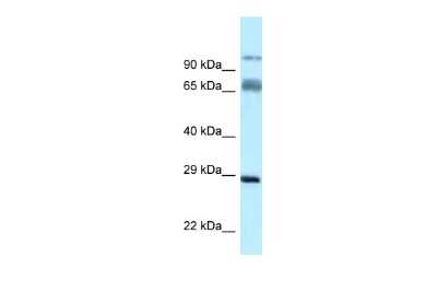 Western Blot: PRRT1 Antibody [NBP2-85543]