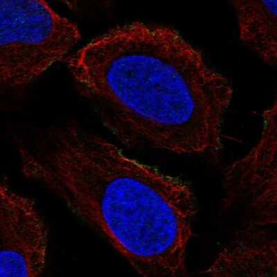 Immunocytochemistry/ Immunofluorescence: PRRT2 Antibody [NBP2-55405]