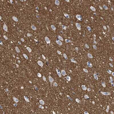 Immunohistochemistry-Paraffin: PRRT2 Antibody [NBP1-84168]