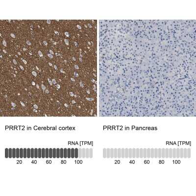 Immunohistochemistry-Paraffin: PRRT2 Antibody [NBP1-84168]