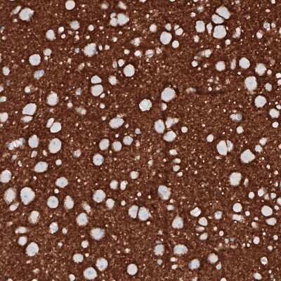 Immunohistochemistry-Paraffin: PRRT2 Antibody (CL4233) [NBP2-59042]