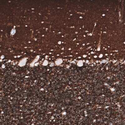 Immunohistochemistry-Paraffin: PRRT2 Antibody (CL4233) [NBP2-59042]