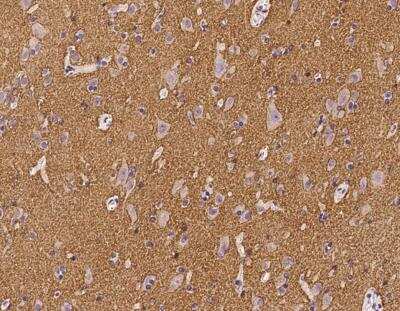 Immunohistochemistry-Paraffin: PRRT2 Antibody [NBP3-12656]