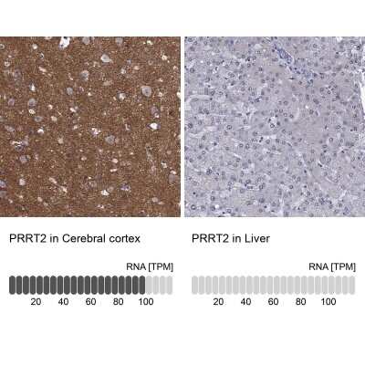 Immunohistochemistry-Paraffin: PRRT2 Antibody [NBP3-17020]