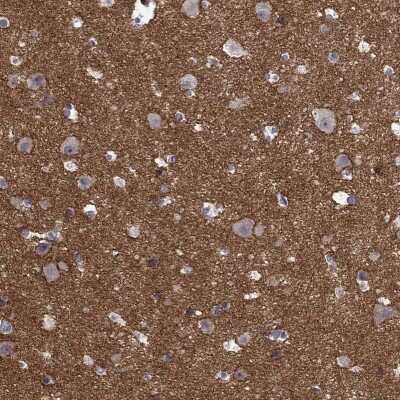 Immunohistochemistry-Paraffin: PRRT2 Antibody [NBP3-17020]