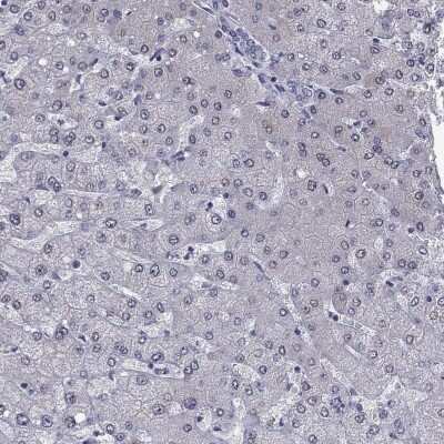 Immunohistochemistry-Paraffin: PRRT2 Antibody [NBP3-17020]