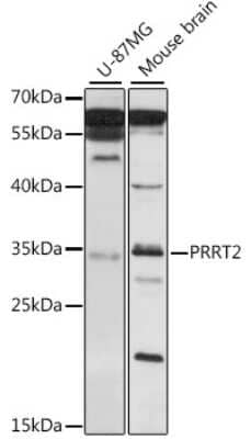 Western Blot: PRRT2 AntibodyAzide and BSA Free [NBP2-93633]